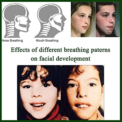 Say Goodbye to Snoring with Azazar Mouth Tape for ...